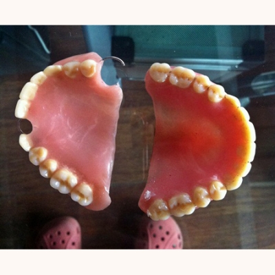 치아모형7