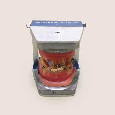 치아모형6